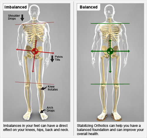 Footlevelers Balanced vs Imbalanced