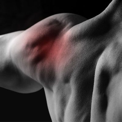 Chiropractic Fullerton CA Shoulder Pain